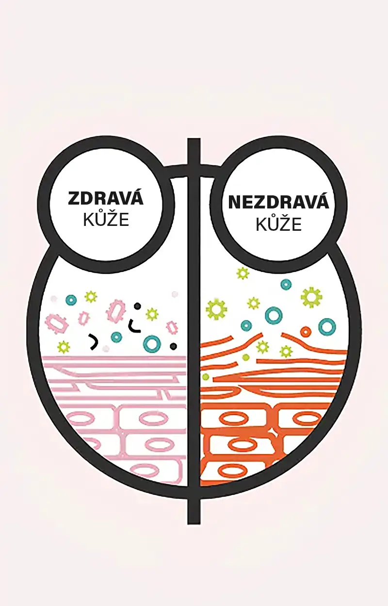 Yun Bakterie Se O Nás Starají.